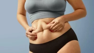 Foto de mujer con grasa corporal