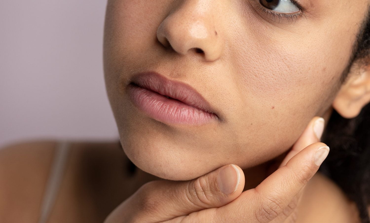 exceso de grasa en tu rostro ácaros / Enfermedades cutáneas que afectan el rostro - piel bonita