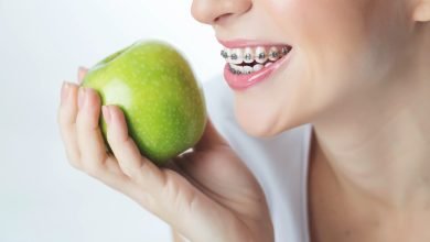 Mujer joven en frenillos con manzana / brackets