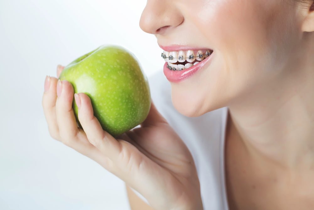 Mujer joven en frenillos con manzana / brackets