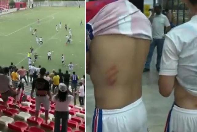 Video: Hubo batalla campal en Barranquilla y a jugadores los golpearon y robaron